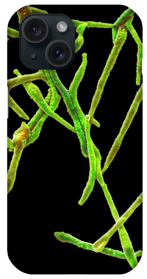 Bacteria iPhone Case featuring the photograph Mycoplasma Pneumoniae #2 by Steve Gschmeissner