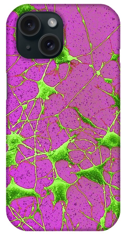 Magnified Image iPhone Case featuring the photograph Nerve Cells #2 by Steve Gschmeissner
