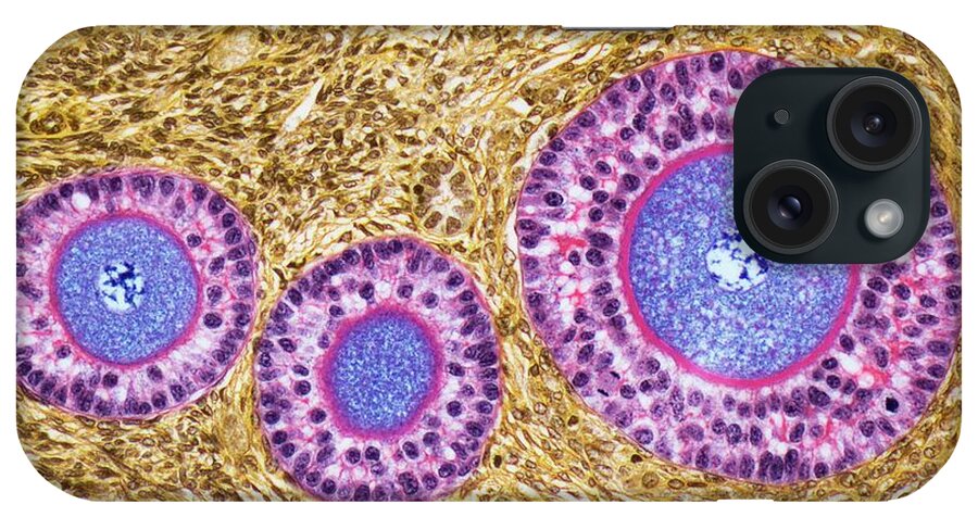 Medicine iPhone Case featuring the photograph Ovarian Follicles #2 by Steve Gschmeissner/science Photo Library
