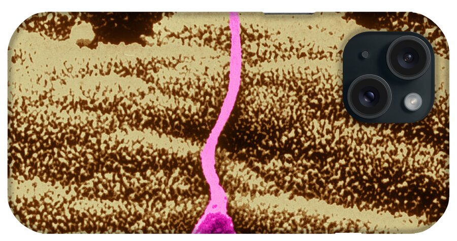 Dark Field Microscopy iPhone Case featuring the photograph Human Sperm In Uterus #3 by John Watney