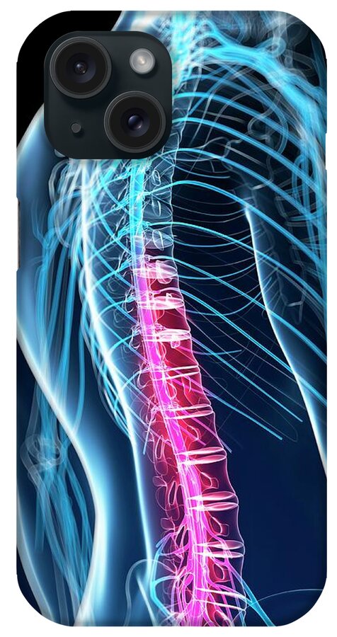 Artwork iPhone Case featuring the photograph Human Spinal Cord #3 by Sebastian Kaulitzki