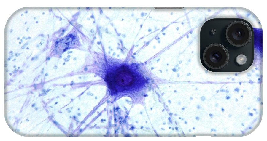 Multipolar Neuron iPhone Case featuring the photograph Nerve Cells #3 by Steve Gschmeissner