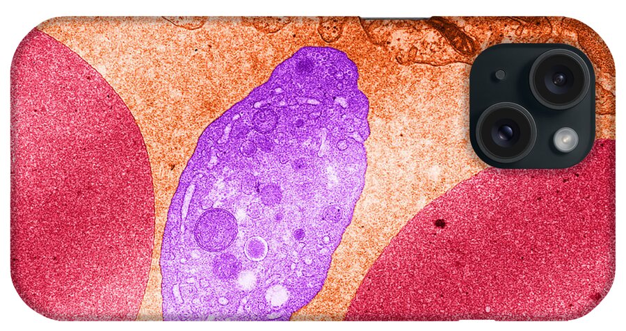Science iPhone Case featuring the photograph Platelet And Red Blood Cells, Tem #3 by David M. Phillips