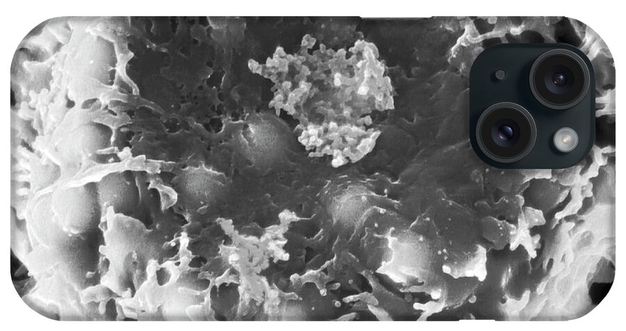 Human Disease iPhone Case featuring the photograph T Lymphocyte With Htlv-1 Infection #3 by Dennis Kunkel Microscopy/science Photo Library