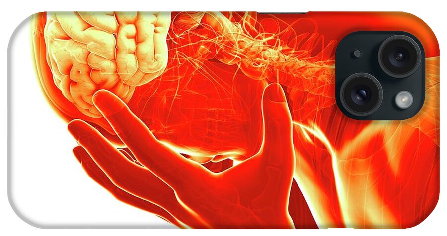 Artwork iPhone Case featuring the photograph Human Brain #35 by Sebastian Kaulitzki
