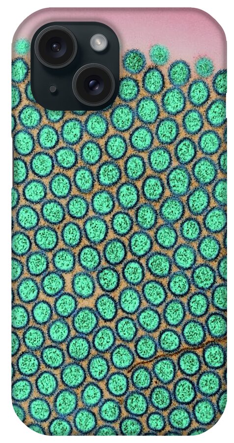 Small iPhone Case featuring the photograph Microvilli Of The Small Intestine #4 by Dennis Kunkel Microscopy/science Photo Library