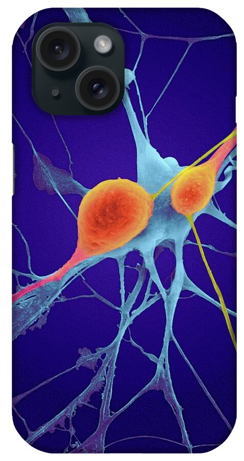 Neuron iPhone Case featuring the photograph Pyramidal Neurons From Cns #4 by Dennis Kunkel Microscopy/science Photo Library