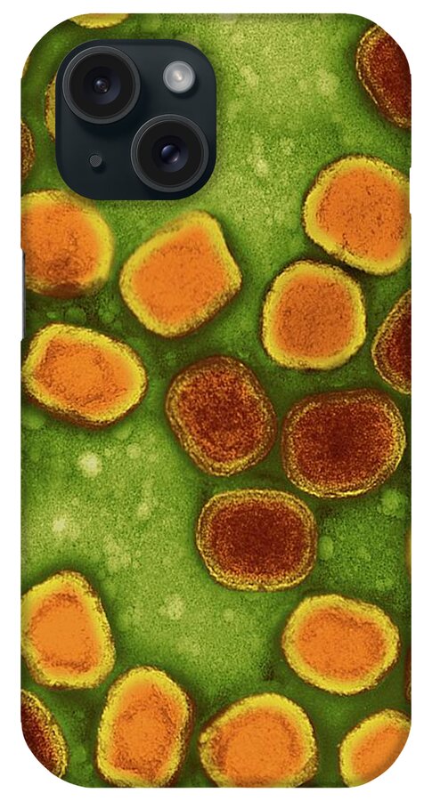 261488k iPhone Case featuring the photograph Variola Virus #4 by Dennis Kunkel Microscopy/science Photo Library