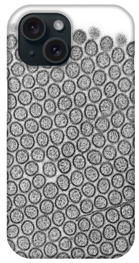 Small iPhone Case featuring the photograph Microvilli Of The Small Intestine #6 by Dennis Kunkel Microscopy/science Photo Library