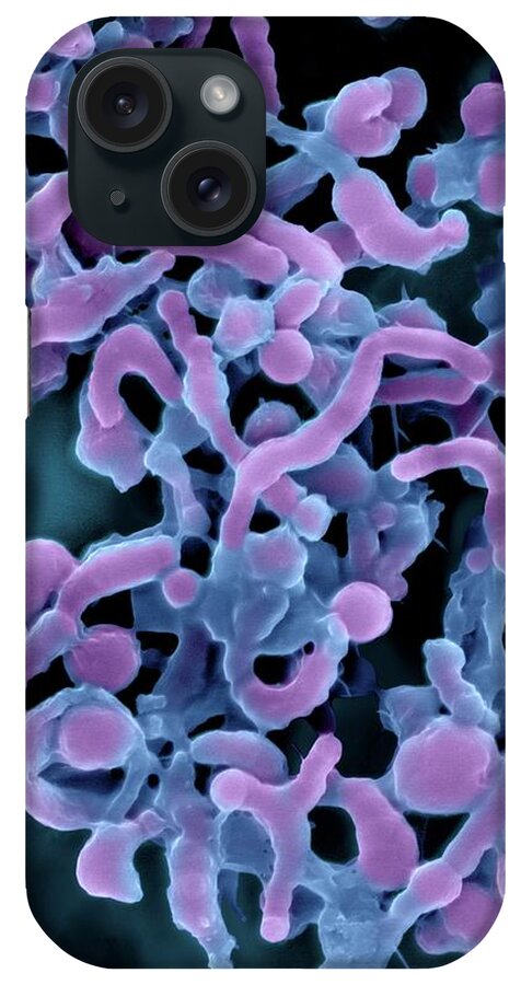 0321330b iPhone Case featuring the photograph Helicobacter Pylori #7 by Dennis Kunkel Microscopy/science Photo Library