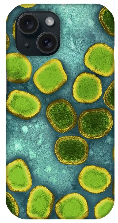 261488j iPhone Case featuring the photograph Variola Virus #7 by Dennis Kunkel Microscopy/science Photo Library