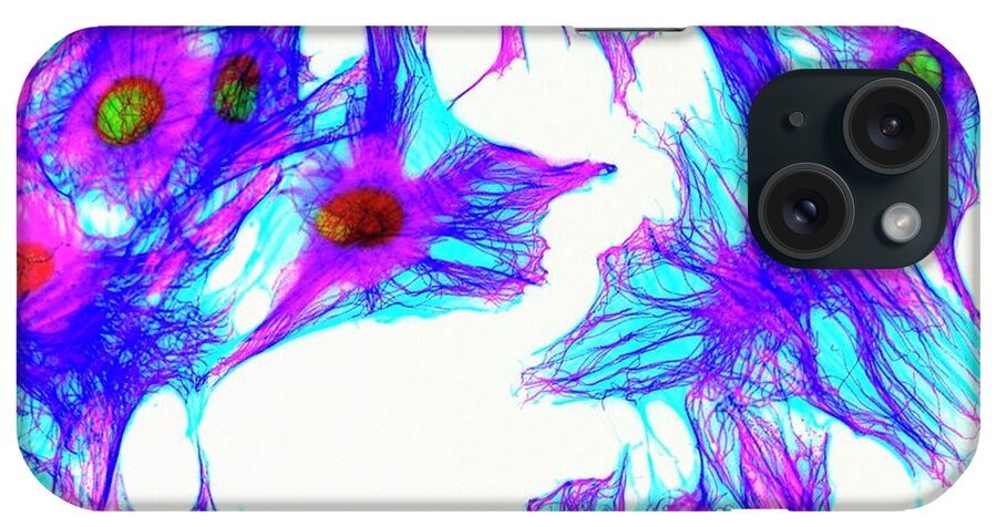 Cell iPhone Case featuring the photograph Cells Stained For Proteins by Kevin Mackenzie / University Of Aberdeen / Science Photo Library