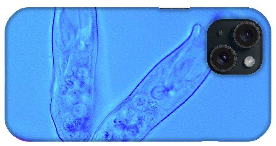 Aquatic iPhone Case featuring the photograph Ciliate Protozoa by Marek Mis