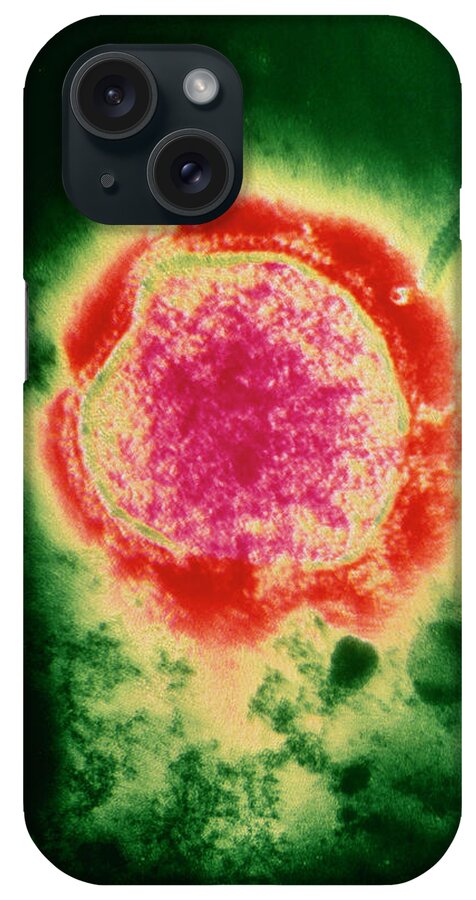 Measles Virus iPhone Case featuring the photograph Coloured Tem Of The Measles Virus by Nibsc/science Photo Library