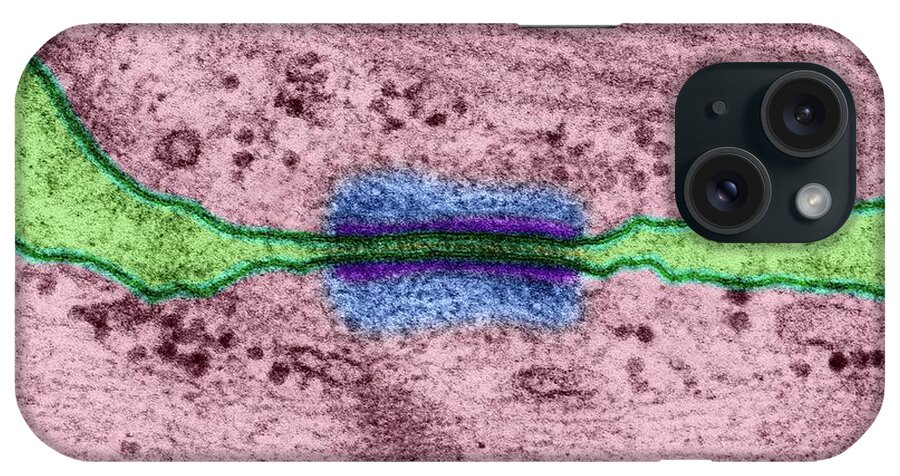 11467b iPhone Case featuring the photograph Desmosome Between Heart Muscle Cells by Dennis Kunkel Microscopy/science Photo Library