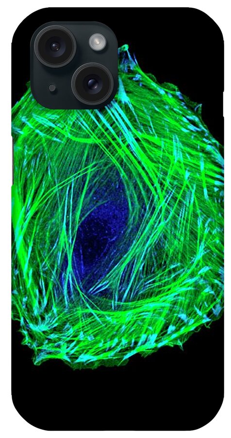 Actin iPhone Case featuring the photograph Embryonic Smooth Muscle Cell by Vira V. Artym, Lcdb/nidcr/national Institutes Of Health