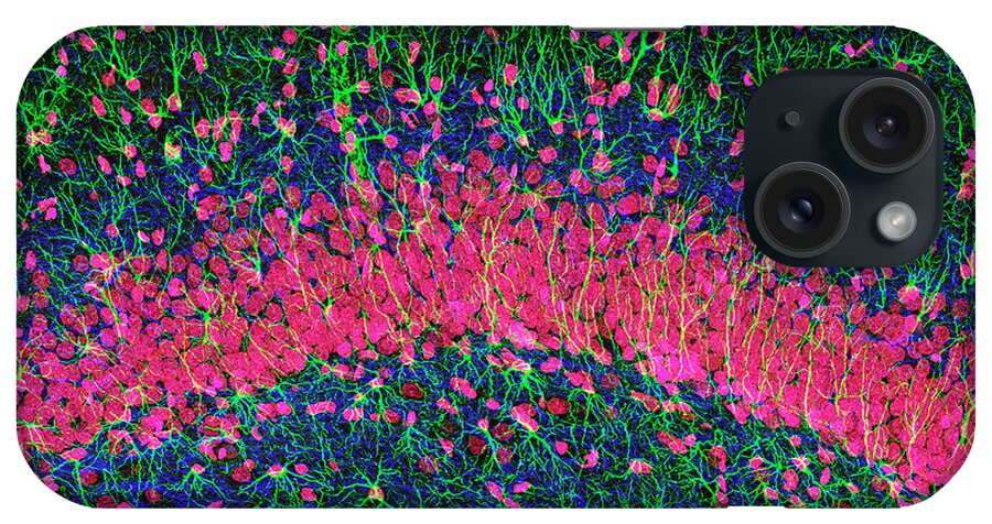 Hippocampus iPhone Case featuring the photograph Hippocampus Brain Tissue by Thomas Deerinck, Ncmir