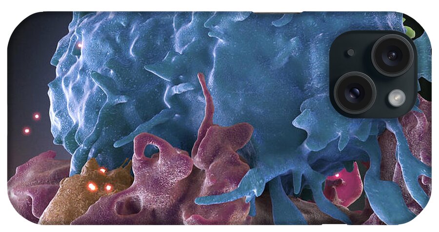 Science iPhone Case featuring the photograph Hiv-infected And Normal T Cells by Science Source