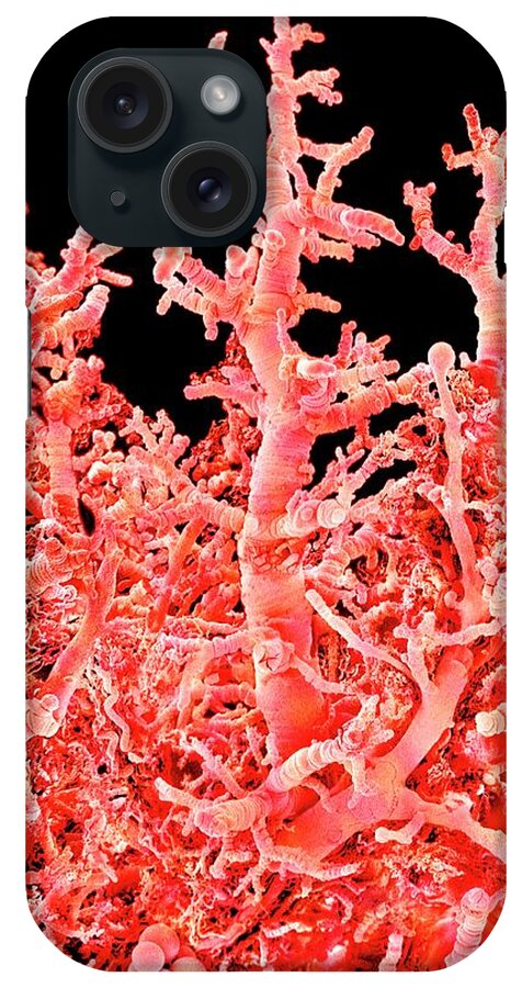 Villus iPhone Case featuring the photograph Lung Blood Vessels by Susumu Nishinaga