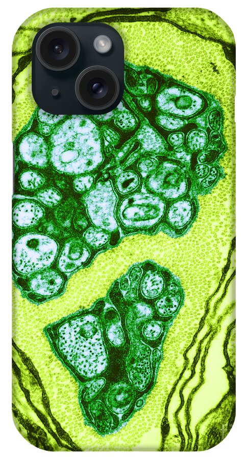 Microscopy iPhone Case featuring the photograph Nerve Cell Axons, Tem by David M. Phillips