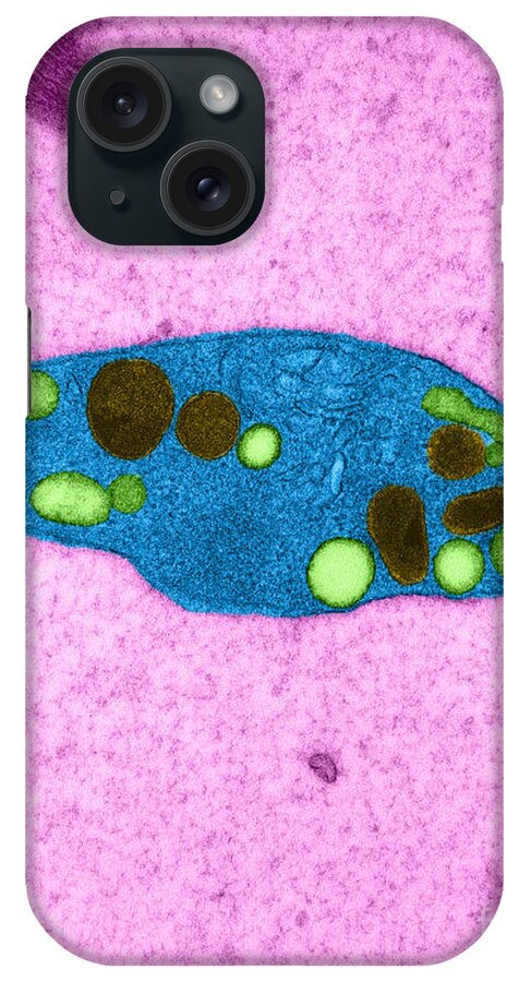 Microscopy iPhone Case featuring the photograph Platelet, Tem by David M. Phillips