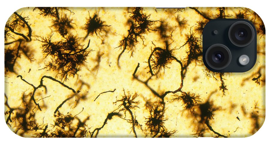 Astrocyte iPhone Case featuring the photograph Protoplasmic Astrocytes, Lm by Michael Abbey