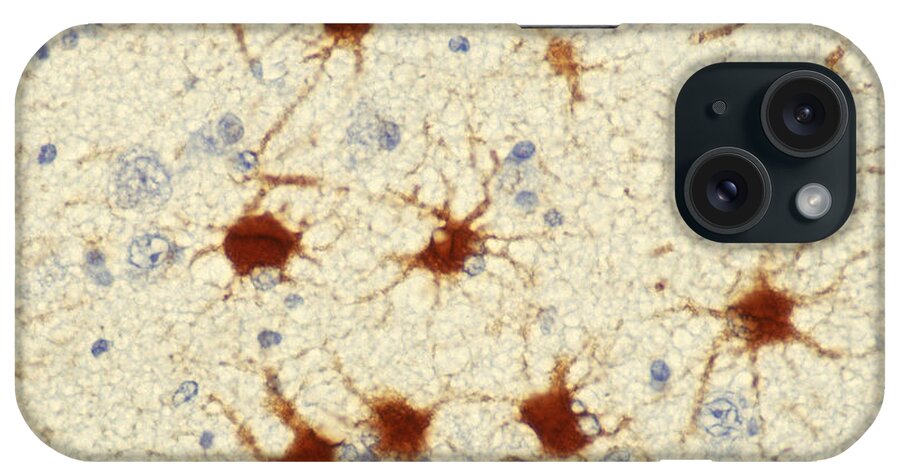Neurone iPhone Case featuring the photograph Protoplasmic Astrocytes by Ralph C. Eagle, Jr.