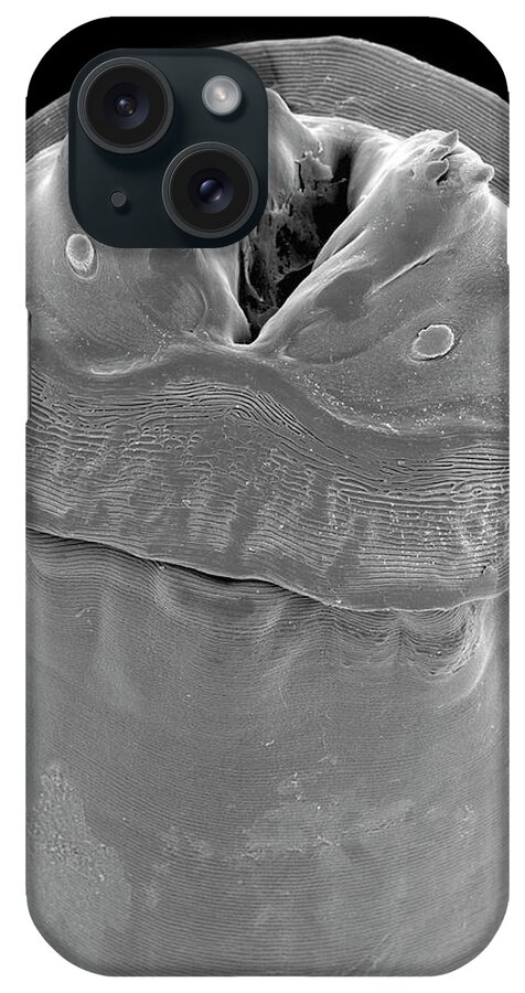 23631c iPhone Case featuring the photograph Raccoon Intestinal Roundworm by Dennis Kunkel Microscopy/science Photo Library
