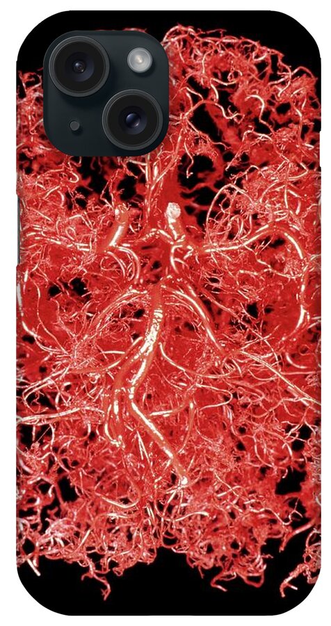 Human Body iPhone Case featuring the photograph Resin Cast Of Blood Supply To The Brain by Science Photo Library