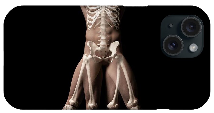Artwork iPhone Case featuring the photograph Vitruvian Man Skeleton by Sebastian Kaulitzki