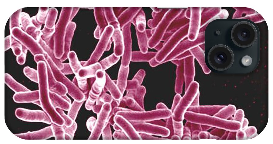 Microbiology iPhone Case featuring the photograph Mycobacterium Tuberculosis Bacteria, Sem #2 by Science Source