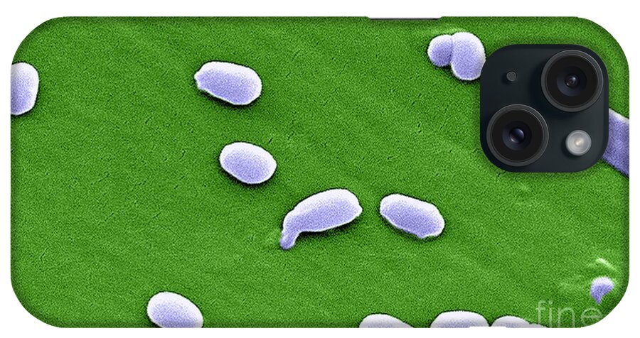 Science iPhone Case featuring the photograph Anthrax Bacteria, Sem #3 by Science Source