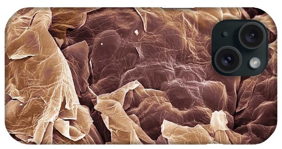 Squamous Epithelium iPhone Case featuring the photograph Skin, Sem #4 by Steve Gschmeissner