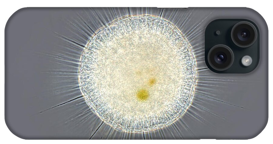 Light Microscopy iPhone Case featuring the photograph Actinosphaerium, Phase Contrast by M. I. Walker