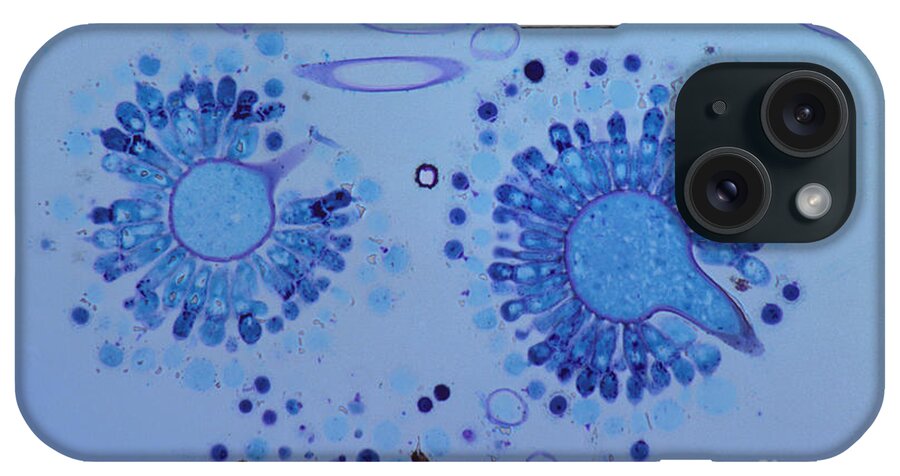 Biology iPhone Case featuring the photograph Aspergillus Spores Lm by M. I. Walker