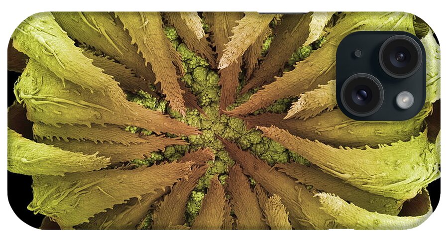 Daisy iPhone Case featuring the photograph Daisy Bud, Sem by Steve Gschmeissner