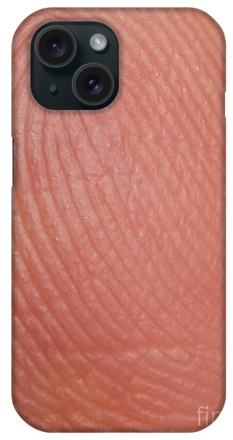 Finger iPhone Case featuring the photograph Fingerprint Ridges by Photo Researchers, Inc.