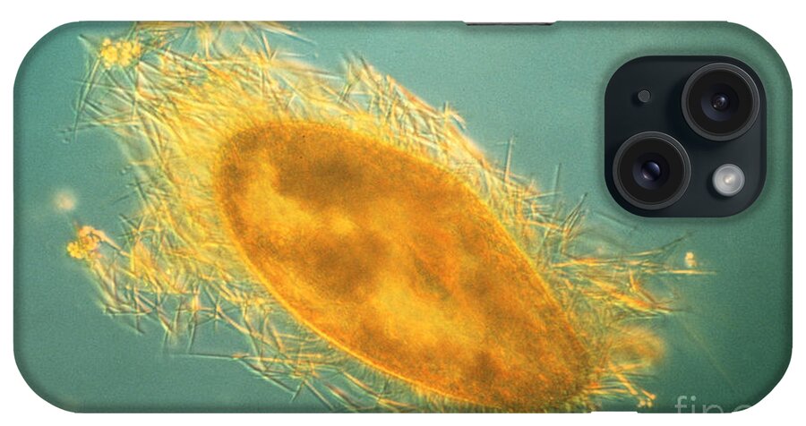 Microorganism iPhone Case featuring the photograph Paramecium With Ejected Trichocysts by Eric V Grave