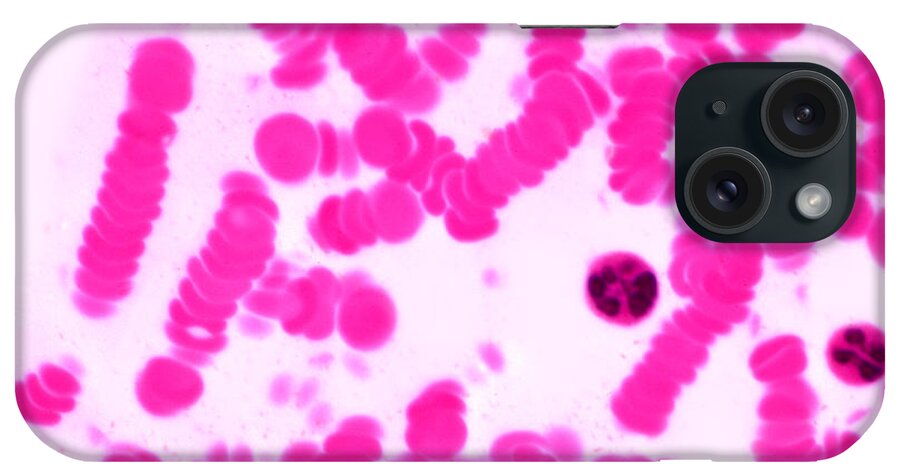 Light Microscopy iPhone Case featuring the photograph Primate Blood by M. I. Walker