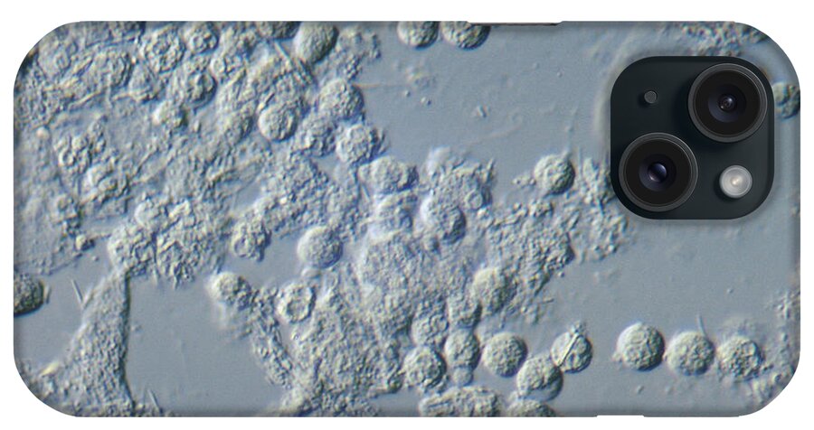 Leukocyte iPhone Case featuring the photograph Pus by M. I. Walker