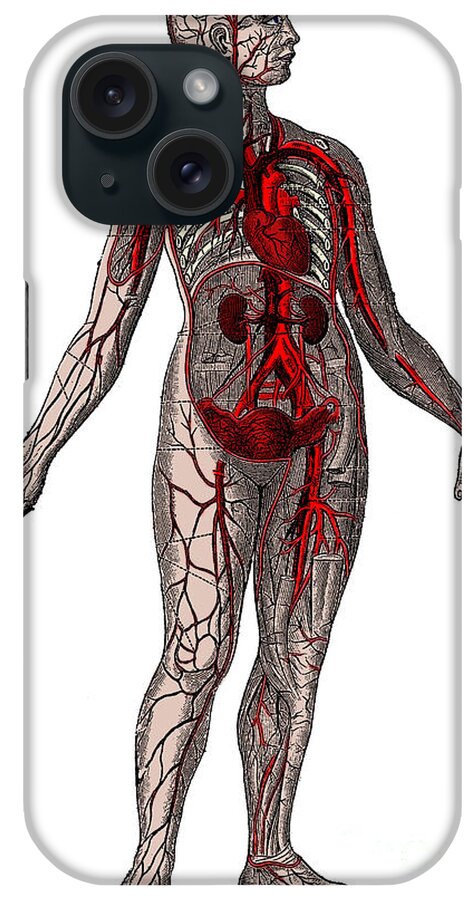Human iPhone Case featuring the photograph Vascular System by Science Source