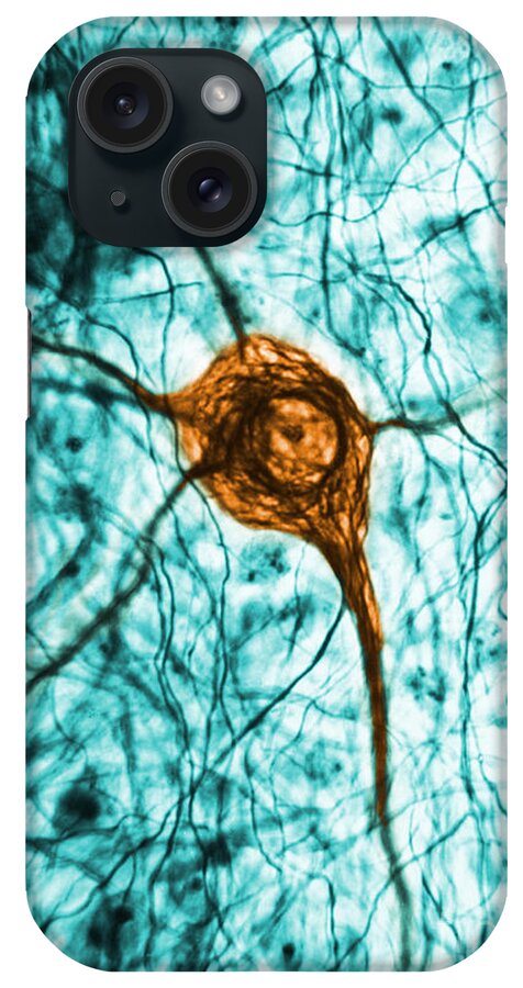 Cell iPhone Case featuring the photograph Neuron, Tem #1 by Science Source