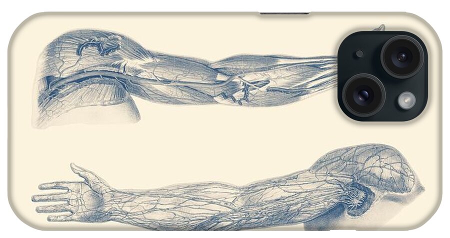 Arm Anatomy iPhone Case featuring the drawing Arm and Hand Diagram - Quad View - Vintage Anatomy Print by Vintage Anatomy Prints