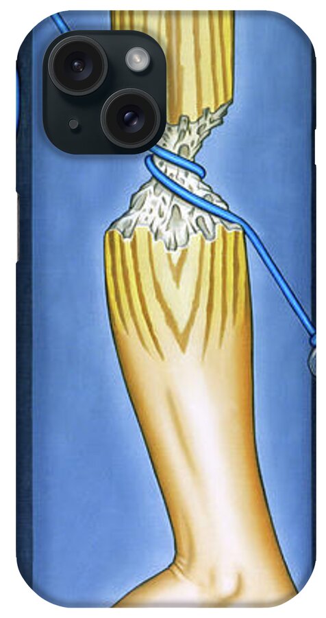  iPhone Case featuring the painting The Waiting Room by Paxton Mobley