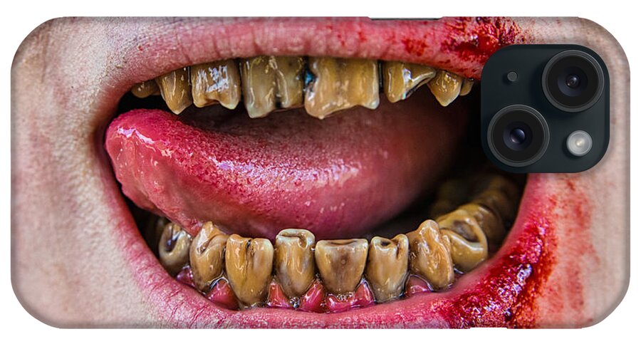 Teeth iPhone Case featuring the photograph Zombie mouth and teeth by Matthias Hauser
