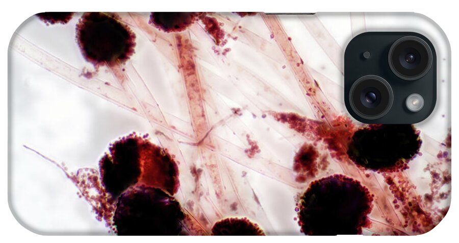 Agar iPhone Case featuring the photograph Aspergillus Fungus #1 by Choksawatdikorn / Science Photo Library