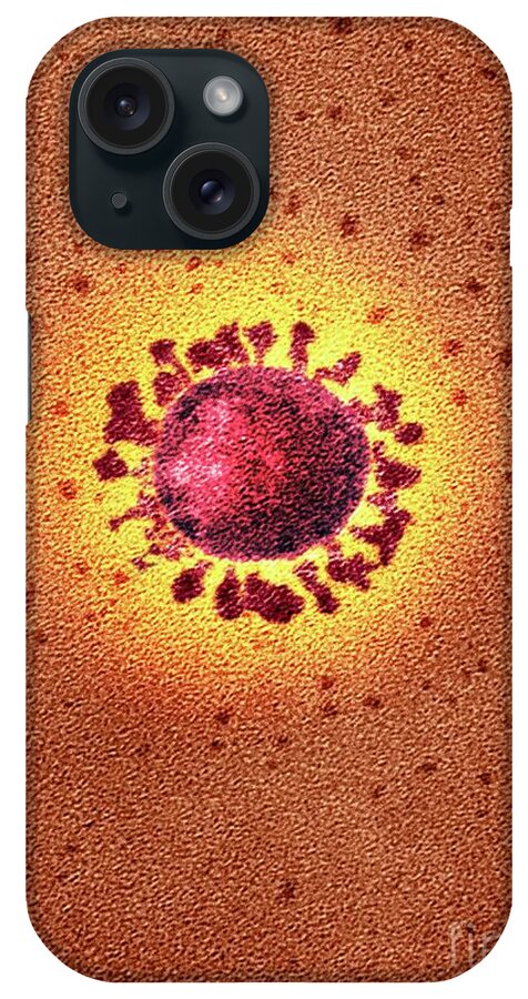 2019 iPhone Case featuring the photograph Covid-19 Coronavirus #1 by National Infection Service / Science Photo Library