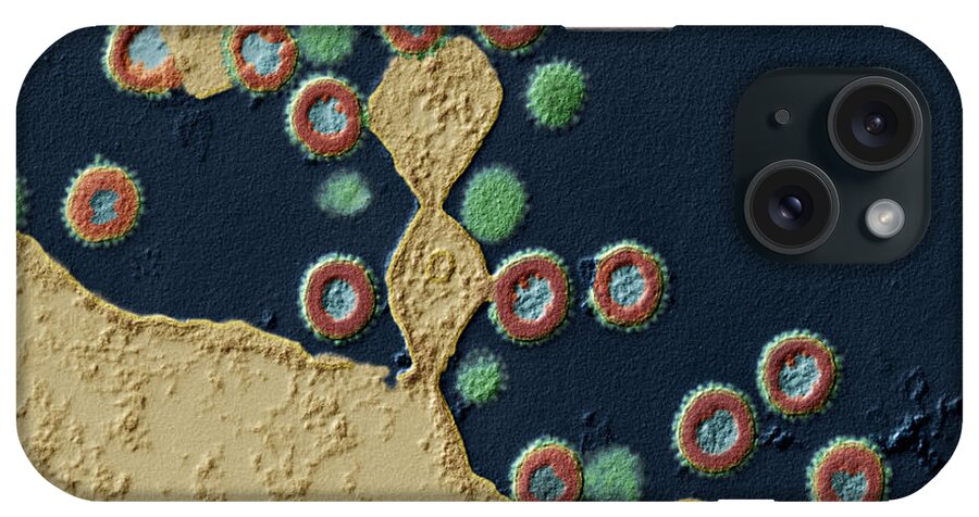 Acquired Immune Deficiency iPhone Case featuring the photograph Effect Of Protease Inhibitors On Hiv Tem by Meckes/ottawa