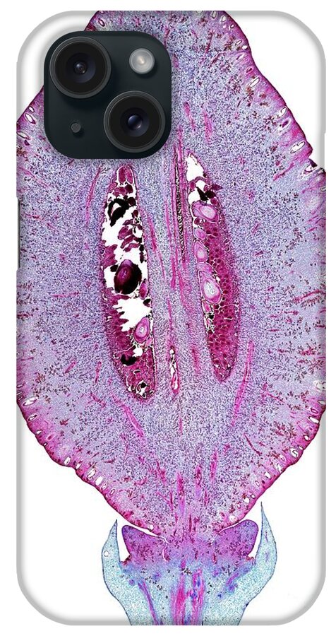 Anatomy iPhone Case featuring the photograph Lemon #1 by Dr Keith Wheeler/science Photo Library