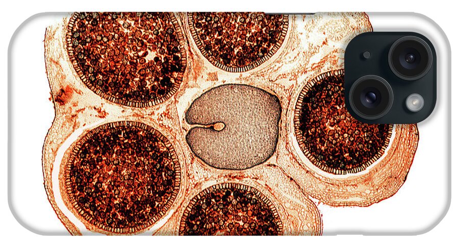 Conocephalum Conicum iPhone Case featuring the photograph Liverwort Spore Cases #1 by Dr Keith Wheeler/science Photo Library